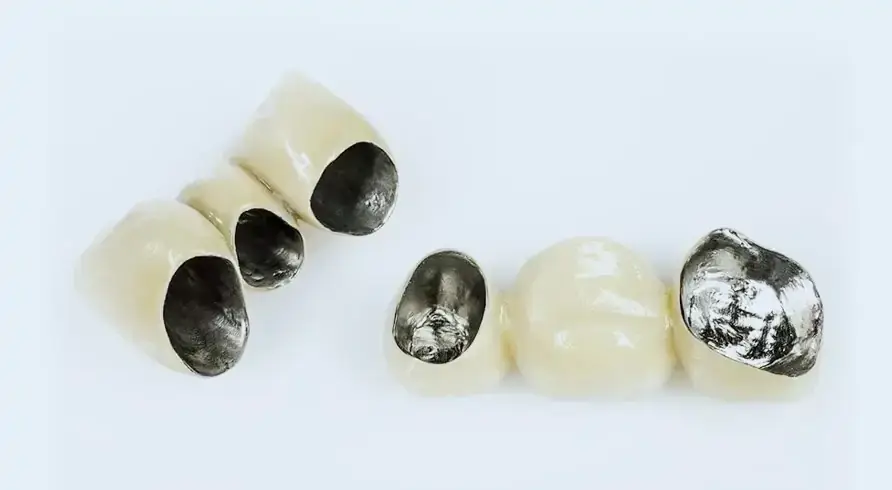 Никель-хромовые коронки